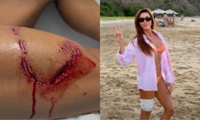 Turista é mordida por tubarão durante mergulho em fernando de noronha