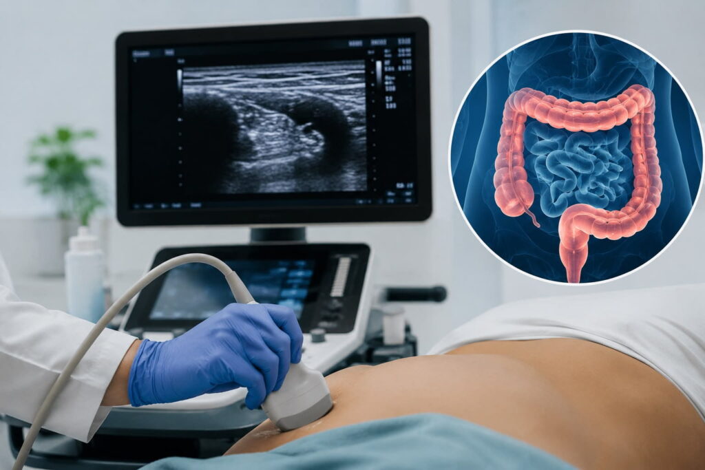 Ultrassonografia intestinal amplia monitoramento da doença inflamatória intestinal